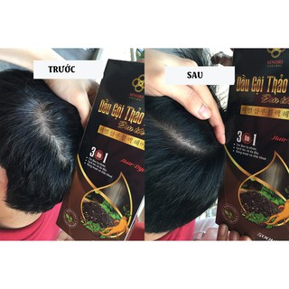 DẦU GỘI THẢO DƯỢC ĐEN TÓC