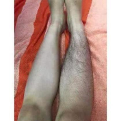 Kem tẩy lông collagen