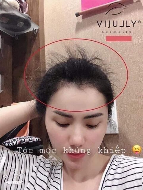 [Kèm quà xinh] Tinh Dầu Bưởi ViJully Kích mọc tóc-Trị rụng tóc-Làm dài tóc 100% Thiên Nhiên | BigBuy360 - bigbuy360.vn