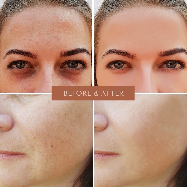 Vitamin E đỏ viên uống đẹp da giảm nám mờ nhăn chống lão hoá