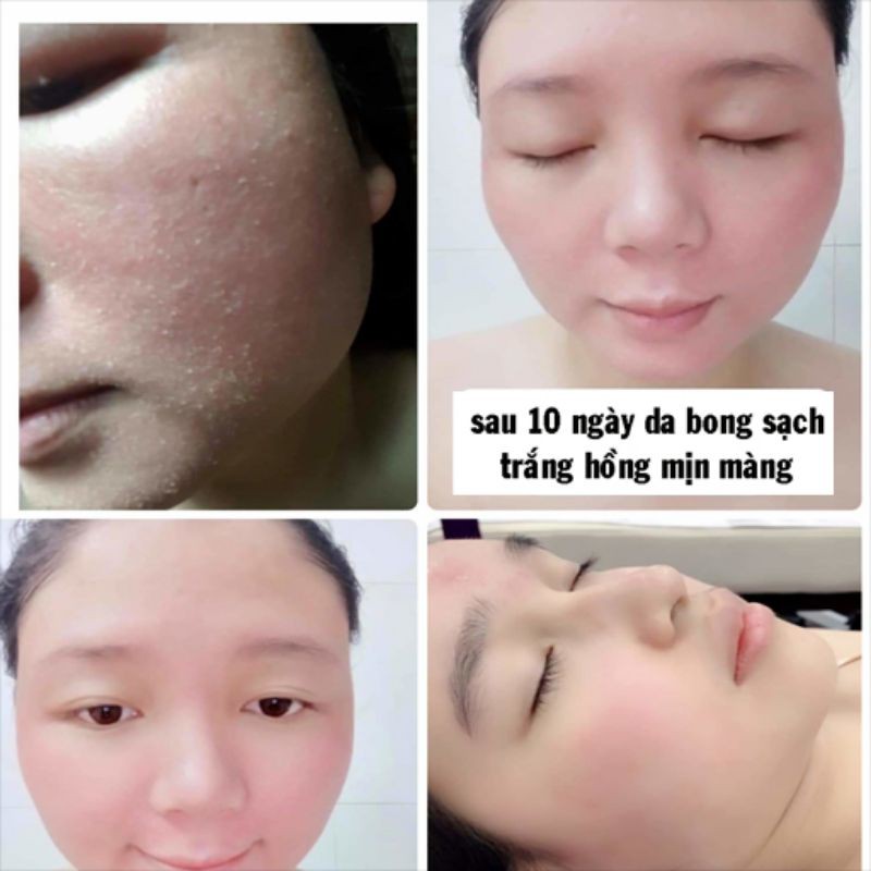 KEM BONG TÁI TẠO TRẮNG DA