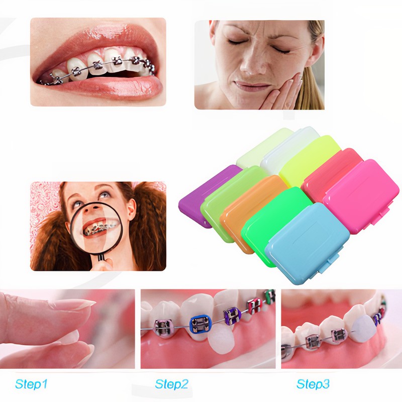 [MUA  5 TẶNG 1] Sáp nha khoa cao cấp giảm đau cho người đang niềng răng, sáp không mùi, tuyệt đối an toàn khi nuốt vào