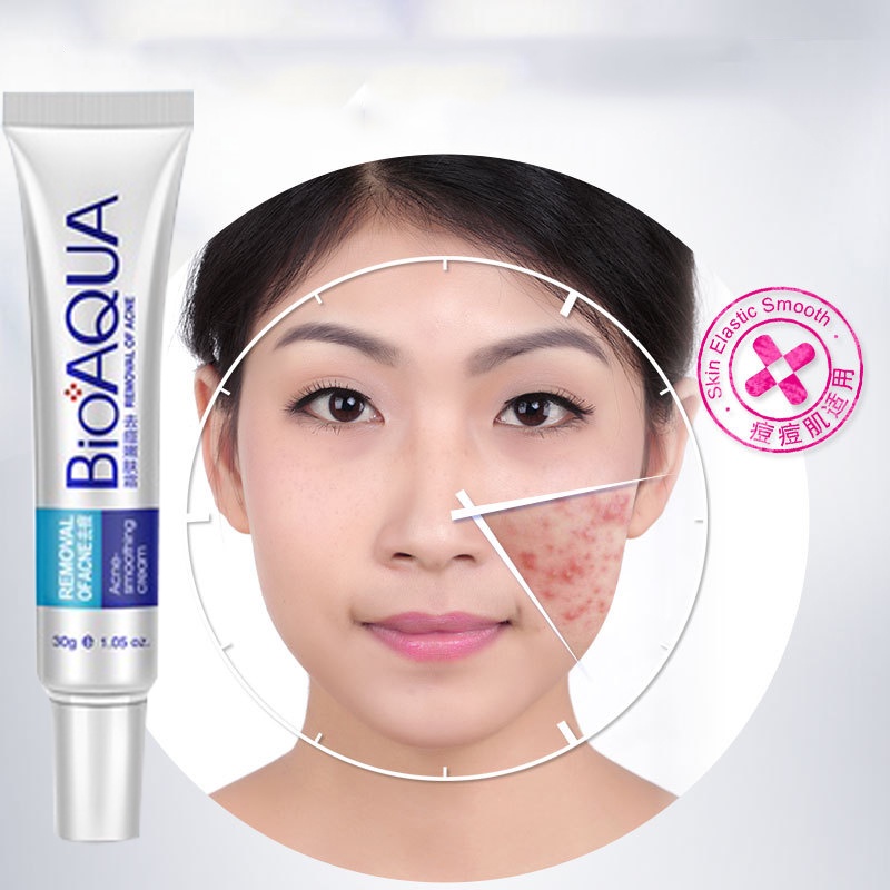 Kem giảm mụn,BIOAQUA, ngừa rạn da,sẹo, thâm,mụn lưng,mau lành vết thương, nam, nữ, tuổi dậy thì 30g hàng chính hãng.