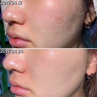 [FREE SHIP] Serum Dưỡng Da Cấp Ẩn Phục Hồi B5 Goodndoc