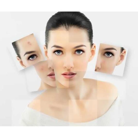 Lotion ngừa mụn hiệu quả IMAGE SKINCARE CLEAR CELL MEDICATED ACNE LOTION - ngochan cosmetic