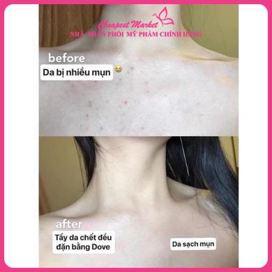 Tẩy Da Chết Toàn Thân DOVE Exfoliating Body Polish Lựu Bơ Hạt Mỡ 298g Bản Mỹ US