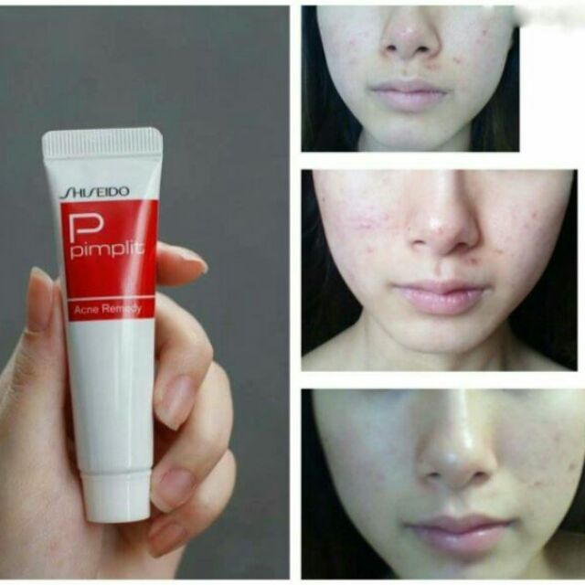 Kem giảm mụn Shiseido Pimplit