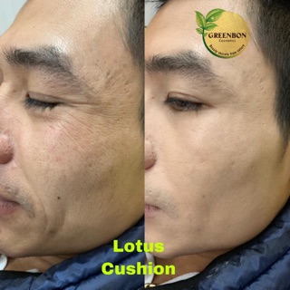 Phấn nước Lotus Cushion Greenbon