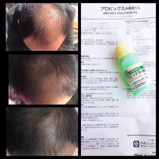 Tinh Chất Mọc Tóc Thảo Dược Sato Nhật Bản30ml