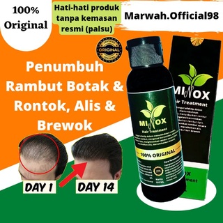 Image of [MINOX] Obat Penumbuh Rambut Botak, Tipis dan Rontok Super Cepat Original Ampuh isi 100 ML