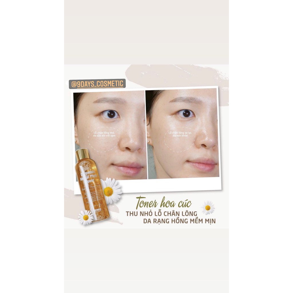TONER HOA CÚC SNO Calendula Herbal Phyto HÀN QUỐC-bản dupe hoàn hảo của toner kiehl’s