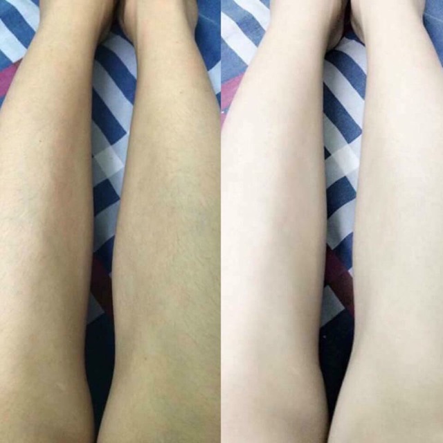 Tắm trắng thuốc bắc và kem body Huyền Phi | BigBuy360 - bigbuy360.vn