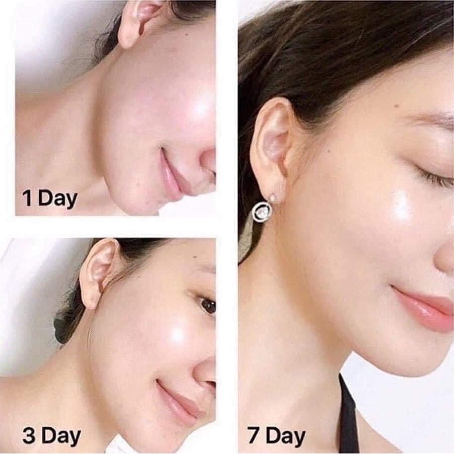 Kem dưỡng Olay total effect 7in1 chống lão hóa làm trắng ban đêm ban ngày Chanh Cosmetics