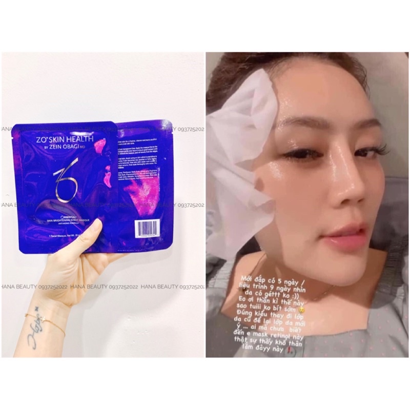 𝐌𝐚̣̆𝐭 𝐧𝐚̣ 𝐝𝐮̛𝐨̛̃𝐧𝐠 𝐭𝐫𝐚̆́𝐧𝐠 𝐝𝐚 𝐙𝐨 𝐎𝐬𝐬𝐞𝐧𝐭𝐢𝐚𝐥 𝐁𝐫𝐢𝐠𝐡𝐭𝐞𝐧𝐢𝐧𝐠 𝐌𝐚𝐬𝐪𝐮𝐞