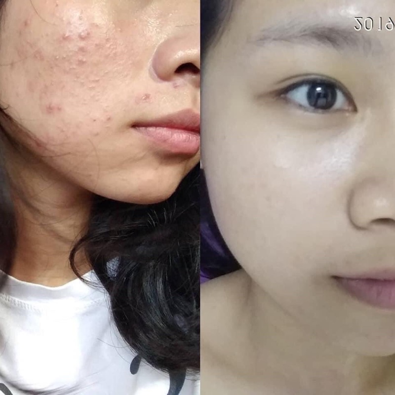 Serum the ordinary nia 10% + zinc 1% | BigBuy360 - bigbuy360.vn