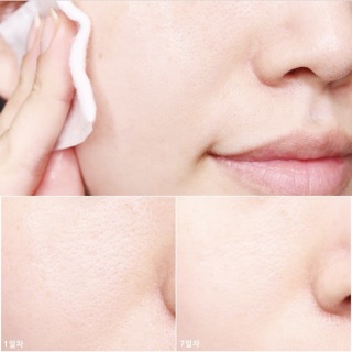 Tẩy da chết Cosrx AHA 7 WHITEHEAD POWDER LIQUID