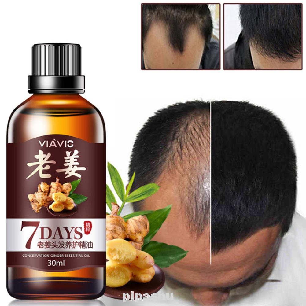 30ml Ginger Anti Loss Maintenance Hair Growth Thicker Moisturizing Natural Essence Oil