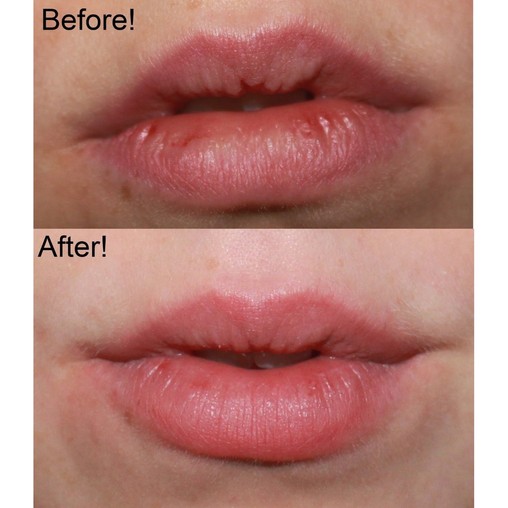 Tẩy Tế Bào Chêt Môi Beauty Treats Lip Scrub Hủ | BigBuy360 - bigbuy360.vn