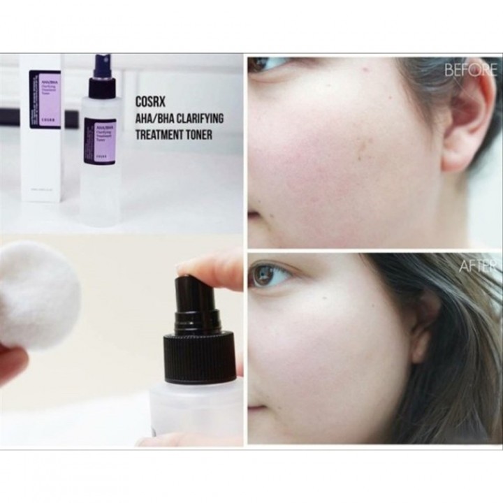 Nước hoa hồng Cosrx AHA/BHA Clarifying Treatment Toner 150ml dành cho da mụn | BigBuy360 - bigbuy360.vn