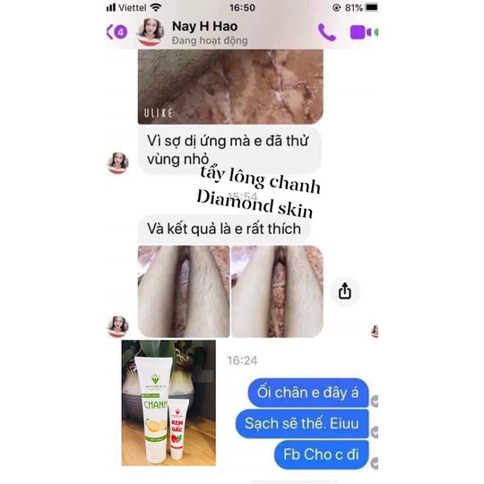 COMBO KEM TẨY LÔNG CHANH GẤC DIAMOND SKIN CHÍNH HÃNG (TRIỆT LÔNG CHANH GẤC DIAMOND SKIN) | BigBuy360 - bigbuy360.vn