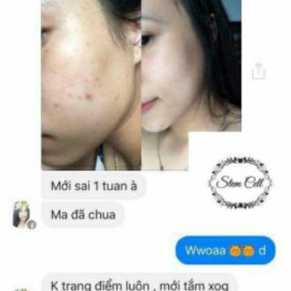 [Siêu hot] Kem trắng da mờ thâm nám Stemcel trắng