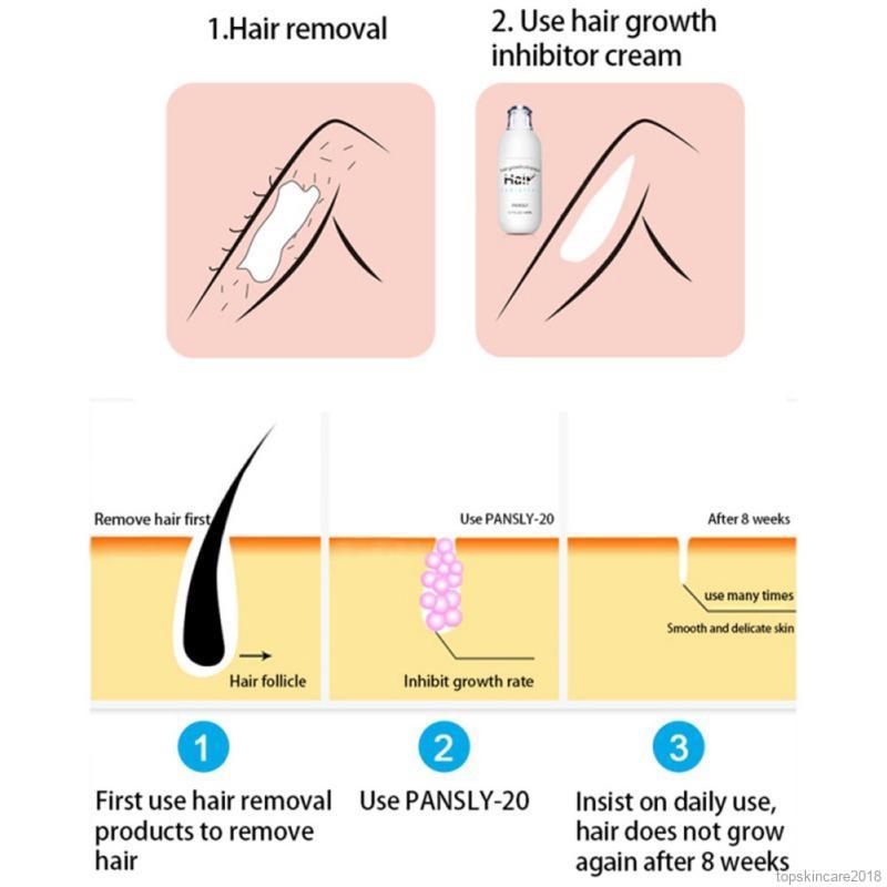 Chai Xịt Ức Chế Mọc Lông Pansly 30ml | BigBuy360 - bigbuy360.vn