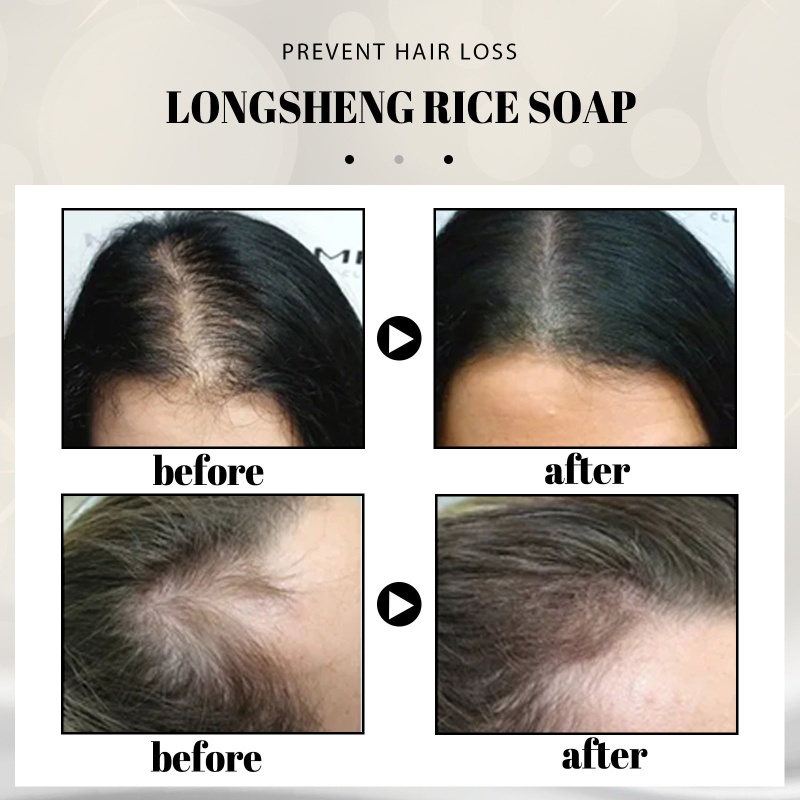 Xà Phòng Gội Đầu Thủ Công Chống Rụng Tóc Kiểm Soát Dầu Tiện Dụng