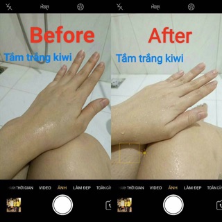 Sữa Kích Trắng MyMiu