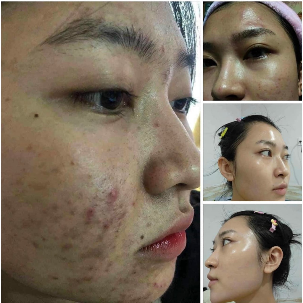 LE’PEAU - Peel da Vi Tảo Retinol  x 2