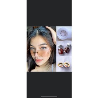 Lens xám giãn nhỏ