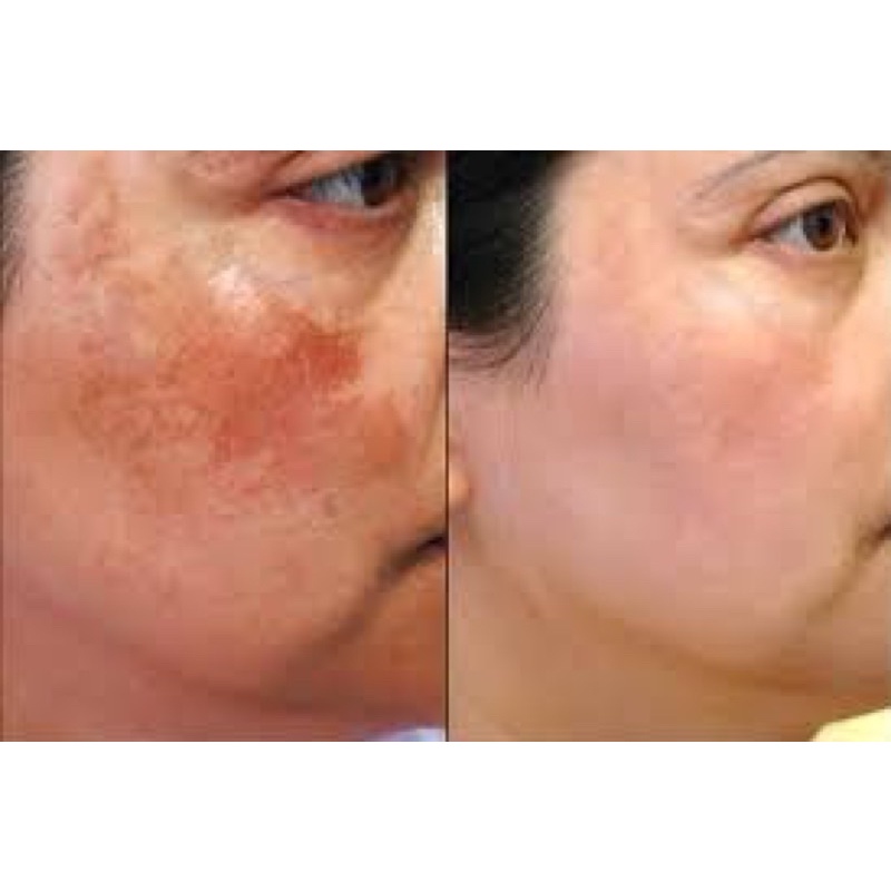 Tinh chất làm mờ nám Filorga Pigment Perfect