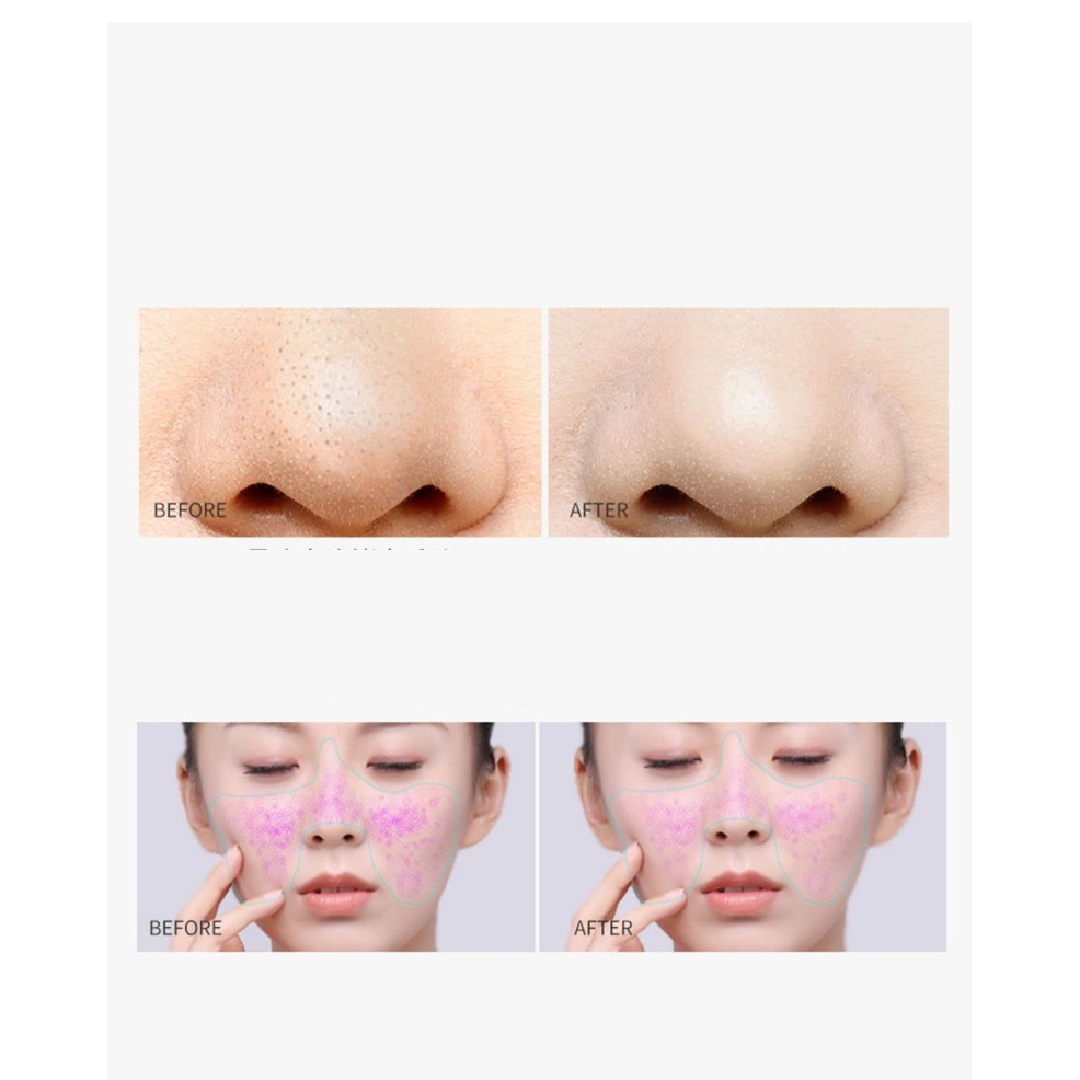 Combo Giảm Mụn đầu đen vùng Mũi Pore no more | BigBuy360 - bigbuy360.vn