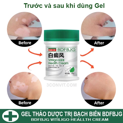 Thảo dược bạch biến DBFB