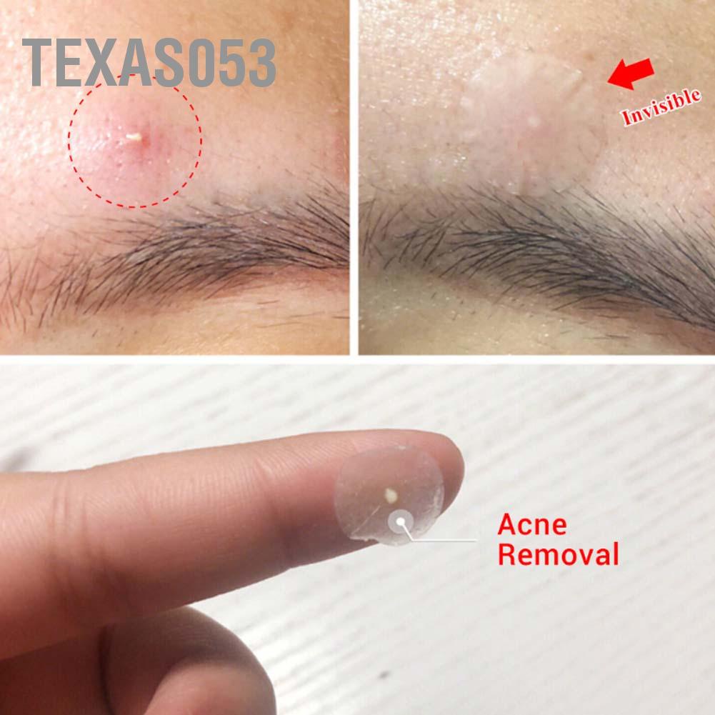 [Hàng mới về] 36 Miếng dán trong suốt sử dụng che khuyết điểm vùng mụn nhọt Texas053