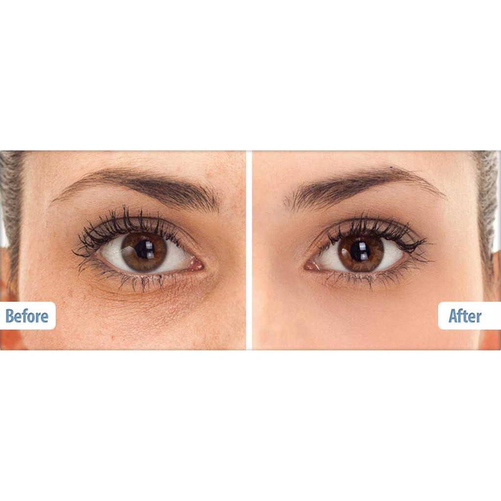 Kem mắt Balance Gold Collagen Active Formula Rejuvenating Eye Serum kem vàng giảm thâm mắt 15ml bản Anh