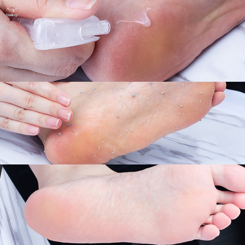 Chai xịt tẩy tế bào chết ở gót chân dưỡng ẩm làm chân mịn