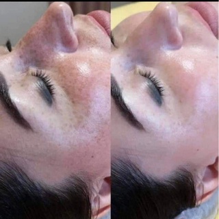 (Chính hãng) Tinh chất DSP làm trắng da mờ thâm nám