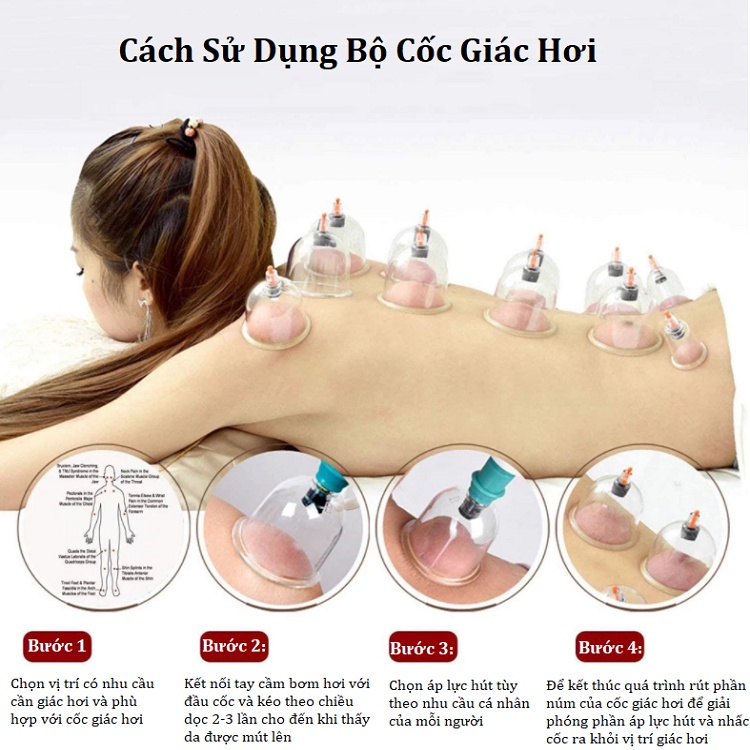 Bộ Giác Hơi Chân Không 12 Cốc, Không Dùng Lửa, Dụng Cụ Cạo Gió Giác Hơi An Toàn Cho Da - Bảo Hành 12 Tháng