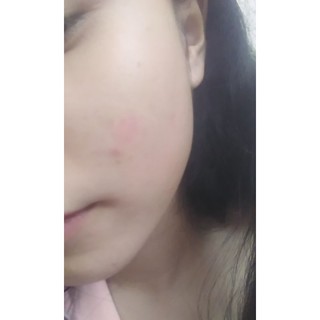 THAY DA MẶT TCA USA