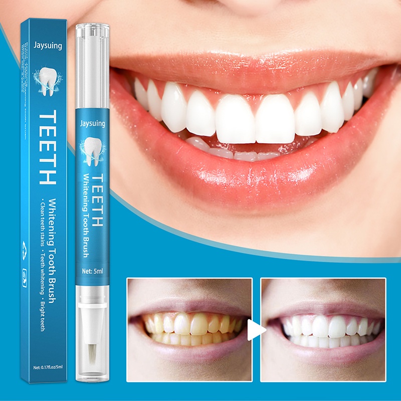 Bút Gel Tẩy Trắng Răng Hiệu Quả