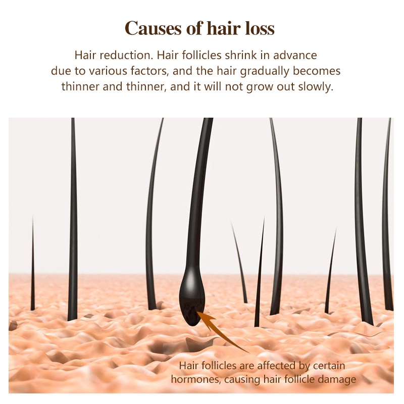 Serum kích thích mọc tóc KOPYRROL tinh chất sinh học cho nam nữ 30ml