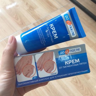 kem dưỡng da tay Kpem Cream xoá tàn nhang nám đ𝐨̂̀𝐢 𝐦𝐨̂̀𝐢 chống lão hoá phục hồi da dưỡng ẩm da dưỡng da tay-𝐓𝐚̣̆𝐧𝐠 𝐦𝐚́𝐲
