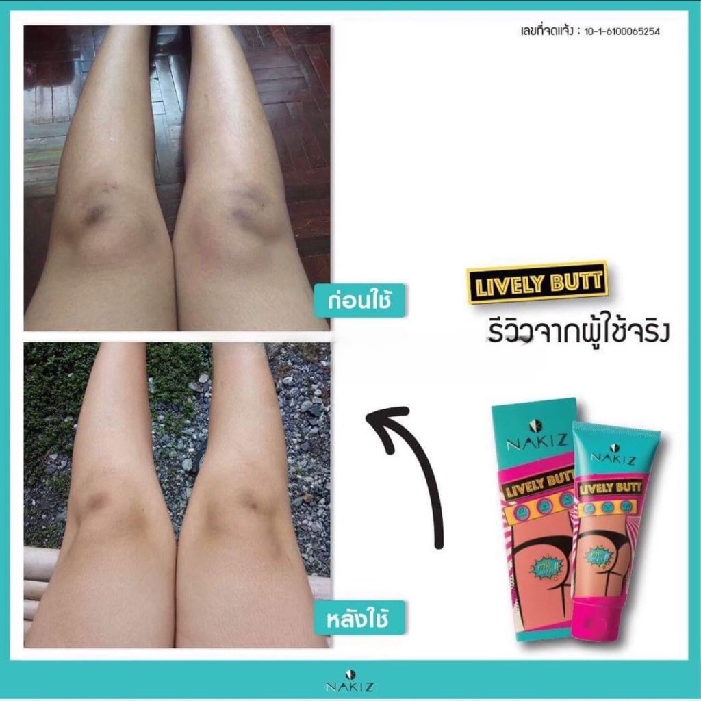 NAKIZ LIVELY BUTT -Kem thoa thâm, mụn Mông, Bẹn, Nách, Lưng, Nhũ hoa, Cùi chỏ, Đầu gối .... Thái Lan