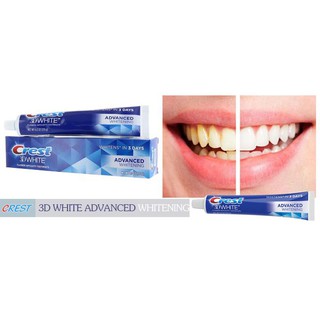 Kem Đánh Răng Crest 3D White Advanced Whitening 158g