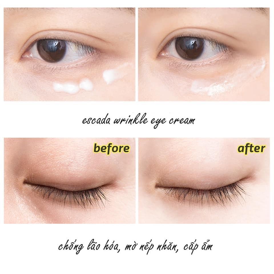 Kem Mắt Ốc Sên Ngừa Lão Hóa LJGO Cha-Skin Snail Wrinkle Care Eye Cream 40ml