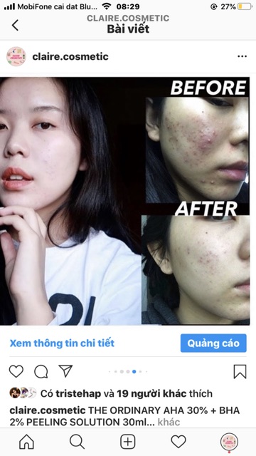 [BILL SEPHORA]THE ORDINARY PEELING SOLUTION AHA BHA TẨY DA CHẾT TẾ BÀO | BigBuy360 - bigbuy360.vn