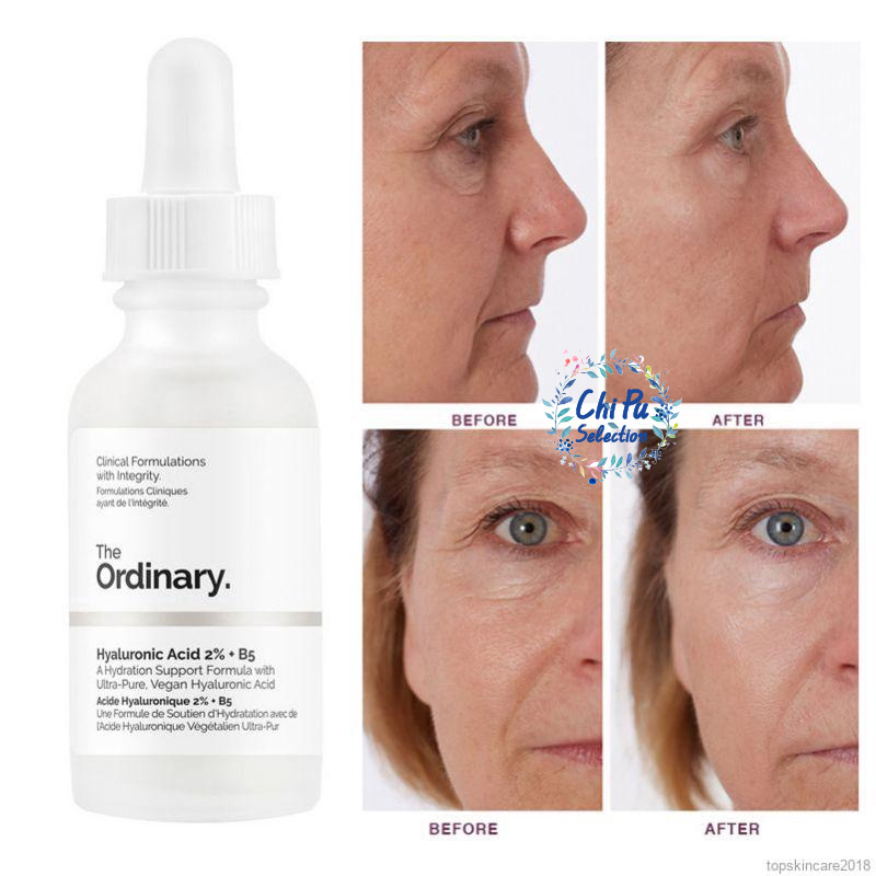 Tinh Chất Cấp Nước Tinh Chất The Ordinary Hyaluronic Acid 2% B5 Serum 30ml