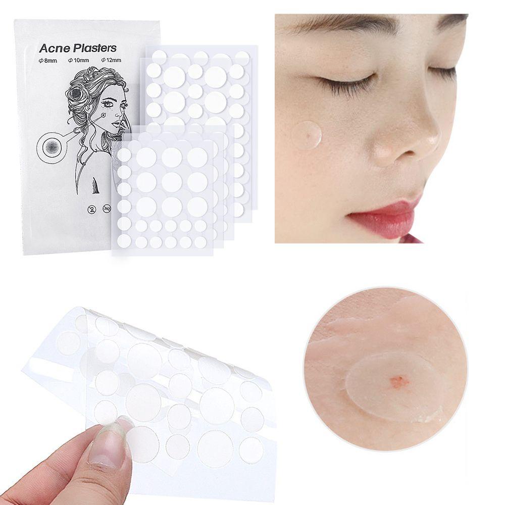 Miếng Dán Hydrocolloid Hỗ trợ giảm mụn Đầu Đen Vô Hình