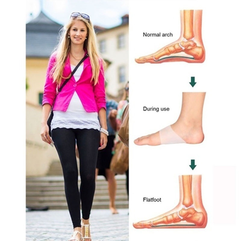 Đệm silicone hỗ trợ chỉnh hình lòng bàn chân phẳng
