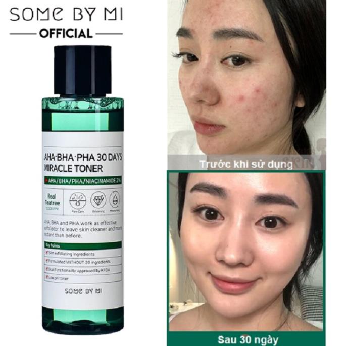 Nước hoa hồng Some By Mi AHA-BHA-PHA 30 Days Miracle Toner 150ml dành cho da mụn | BigBuy360 - bigbuy360.vn